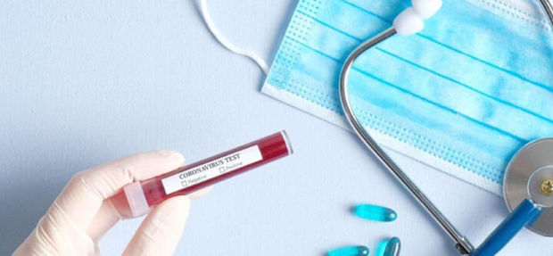 Azərbaycanda daha 132 nəfər koronavirusa yoluxdu, 78 nəfər sağaldı, 1 nəfər öldü