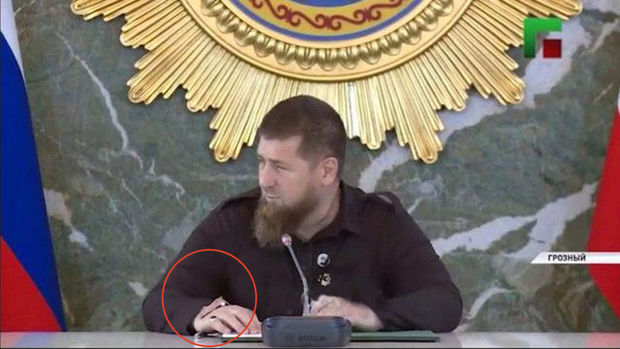 Gizlətməyə çalışdığı əli Kadırovun sirrini açdı - VİDEO