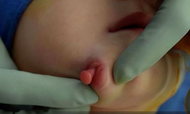 İki ağzı və iki dili olan uşaq dünyaya gəldi - FOTO