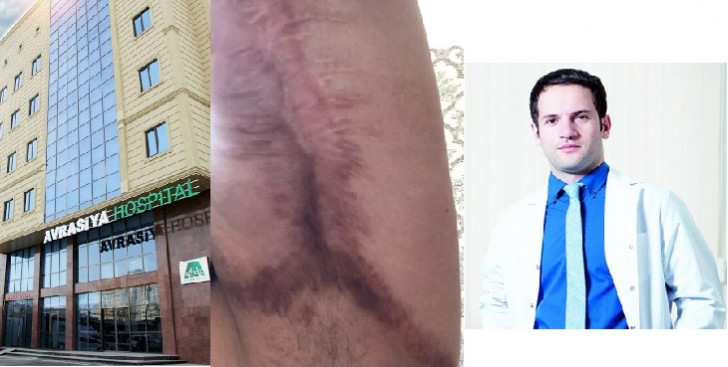 “Avrasiya” klinikasında gənc xanımı şikəst etdilər: daha bir estetik əməliyyat qurbanı-ŞOK GÖRÜNTÜLƏR