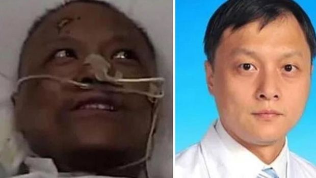 Koronavirusa görə dərisinin rəngi dəyişən həkim öldü