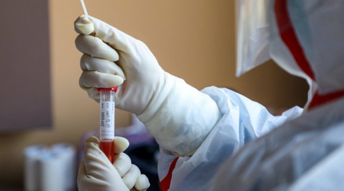 Azərbaycanda koronavirus xəstələrində ən çox hansı simptomlar olur? - Açıqlama