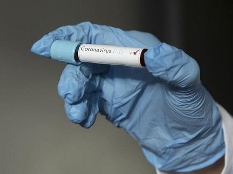 SON DƏQİQƏ: Azərbaycanda yüzlərlə şəxs koronavirusa yoluxdu, ÖLƏNLƏR VAR - Rekord GÖSTƏRİCİ