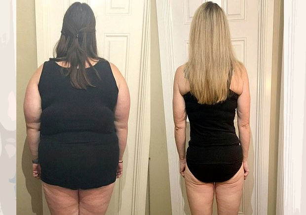 76 kq arıqlayan qadın 18 illik arzusunu gerçəkləşdirdi – FOTO