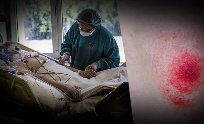 Azərbaycanın qonşusunda yeni dəhşətli virus yayılır - KORONAVİRUSU UNUDUN!