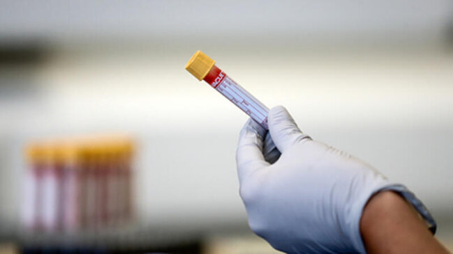 Tanınmış infeksionistdən virusun ikinci dalğası barədə SOS: 