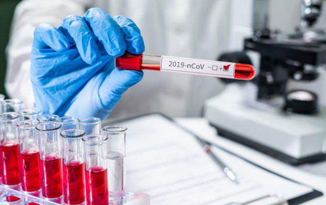 Daha 323 nəfərdə koronavirus aşkarlandı - 5 nəfər vəfat etdi, 228 nəfər sağaldı