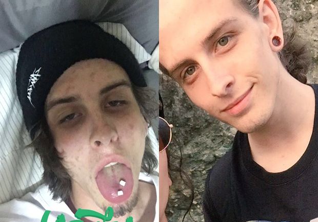 Narkotik asılılığından qurtulan gənc görünüşü ilə təəccübləndirdi - FOTO