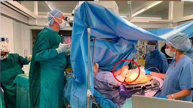 Qadın beyin əməliyyatı zamanı dolma hazırladı - VİDEO