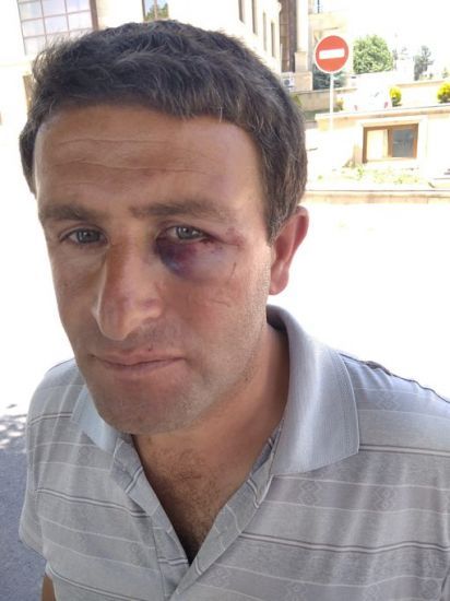 Daşkəsəndə məmur vətəndaşı döydü — VİDEO