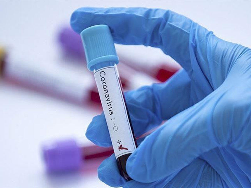 Qırğızıstanda koronavirusa yoluxanların sayı artıb