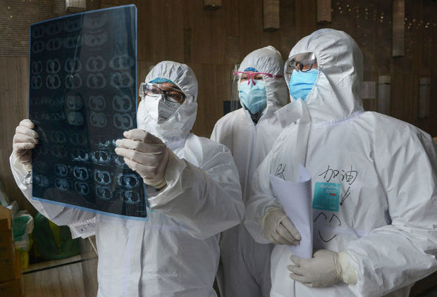 Alimlər koronavirus xəstələrində ömürlük qala biləcək fəsadları açıqladı