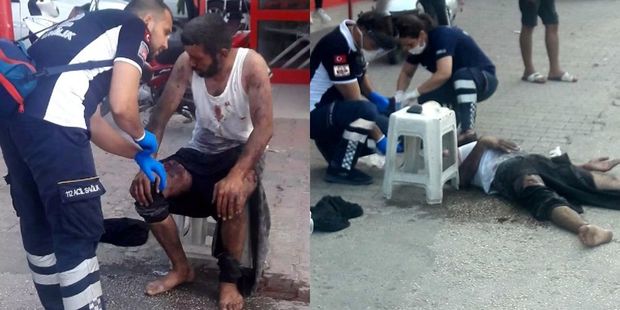 Partlayan təkəri yoxlamaq istəyirdi, az qala canından olacaqdı - FOTO