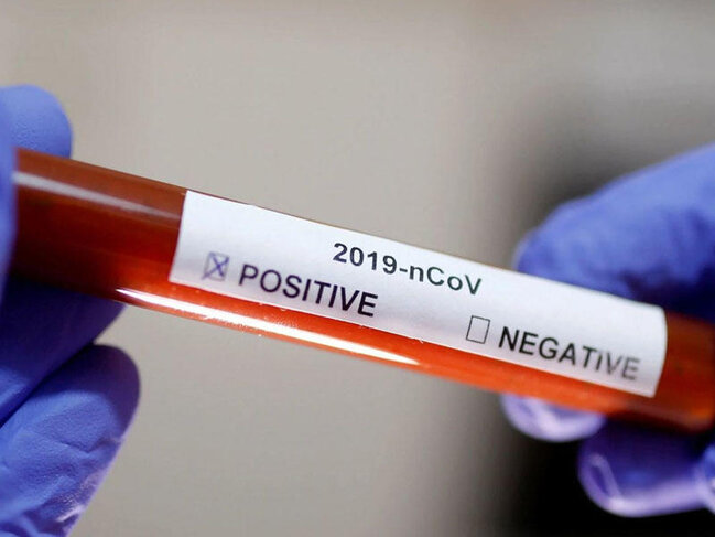 Qırğızıstanda koronavirusa rekord sayda yoluxma qeydə alındı