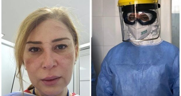 Bakıda pandemiya xəstəxanasının həkimi: “Rentgenə baxırsan, pasiyentin ağciyərləri, sadəcə, yoxdur” - FOTO