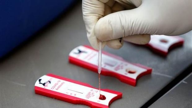 COVID-19-un ikinci dalğasının yayılacağı 10 ölkənin adı açıqlandı