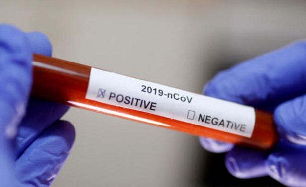 SON DƏQİQƏ: Klinikalar koronavirus testi müayinələrini dayandırdı-SƏBƏB