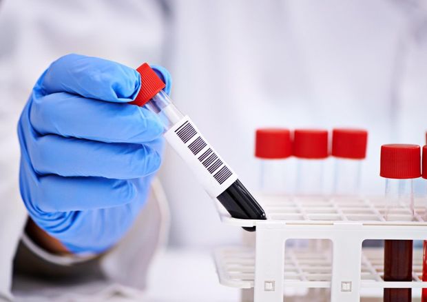 ANS-in tanınmış aparıcısının anası koronavirusdan öldü - FOTO