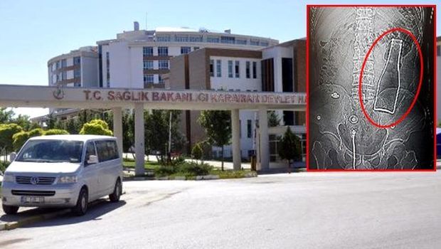 Ağrılarla xəstəxanaya müraciət etmiş şəxsin bədənindən butulka çıxdı - FOTO