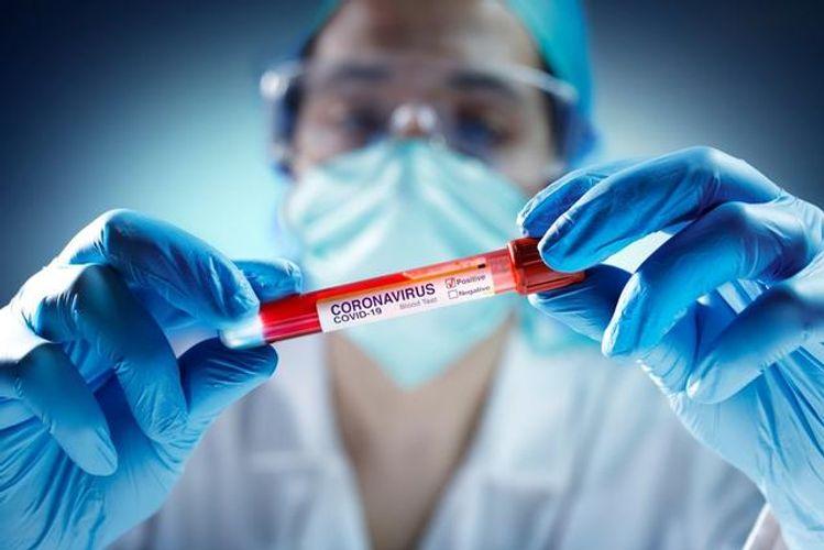 SON DƏQİQƏ: Azərbaycanlı iş adamı və anası koronavirusdan öldü