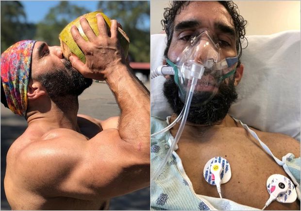 Koronavirusa yoluxan idmançı müalicədən sonra güzgüdə özünü tanımadı - FOTO/VİDEO