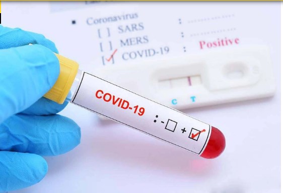 Bu əlamətlərdən biri varsa, təcili COVİD-19 analizi verin