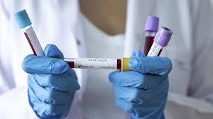 Hansı rayonda neçə koronavirus xəstəsi var?- SİYAHI