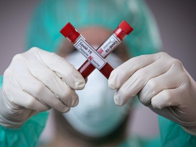 Pakistanda koronavirusa yoluxanların sayı 240 mini ötüb