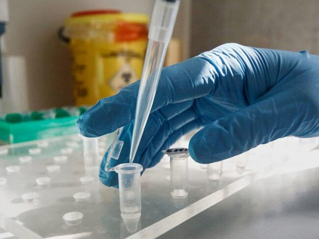 Son sutkada Pakistanda koronavirusdan 74 nəfər ölüb