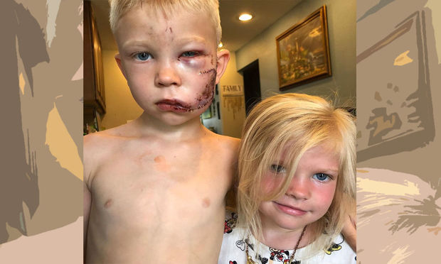 Altı yaşlı uşaq bacısını itdən qorumaq üçün özünü təhlükəyə atdı - FOTO