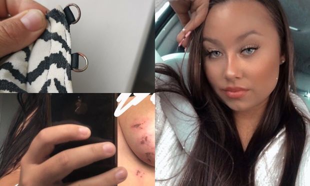 Sifariş verdiyi köynək sinəsində yanıq izləri qoydu - FOTO