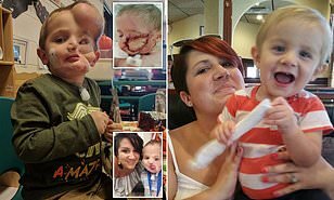 İt uşağı qapıb BU HALA saldı - Uşaqlar 