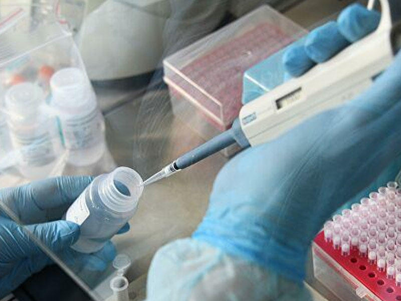 Qırğızıstanda son sutkada koronavirusdan 73 nəfər öldü, 70 tibb işçisi yoluxdu