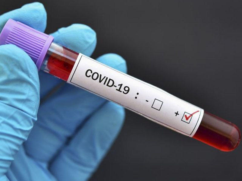 Hindistanda bir sutkada 681 nəfər koronavirusdan vəfat edib