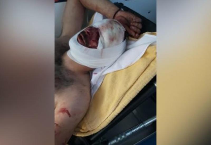 Ermənilərin azərbaycanlalılara qarşı vəhşiliyi - Belçikada - VİDEO 18+