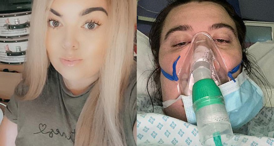 Теперь у меня залысины: переболевшие COVID-19 пожаловались на облысение – ФОТО