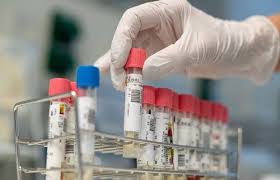 Azərbaycanlıların yaşadığı kənd koronavirusa görə təcrid olundu – RƏSMİ