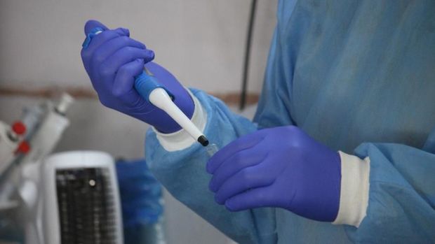 Hindistan da koronavirusa qarşı peyvənd istehsalına başladı