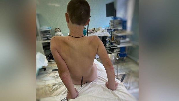 Qarmaq uşağın qarnından girib, belindən çıxdı - FOTO