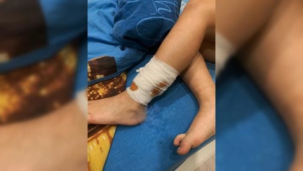 İt sürüsü hamilə qadına və azyaşlı oğluna hücum etdi