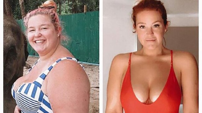 Ana olmaq istəyən qadın 77 kq arıqladı - FOTOLAR