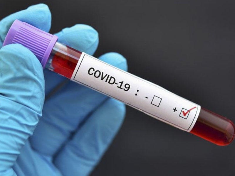 Hindistanda COVID-19-a yoluxanların sayı 2 milyonu ötüb