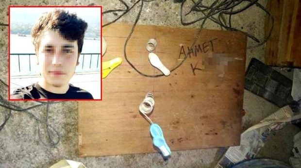 22 yaşlı tələbə evdə sınaq keçirmək istədi, barmaqları qopdu