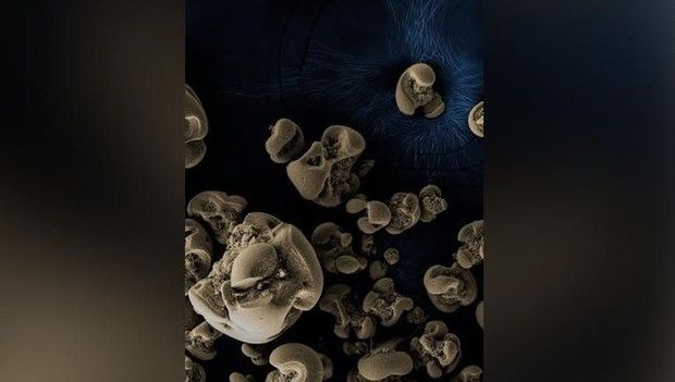 Metal yeyən bakteriya kəşf edildi