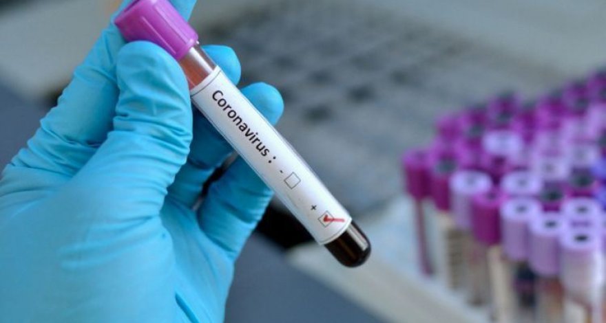 В Азербайджане наблюдается спад заболеваемости коронавирусом - ИНФОГРАФИКА