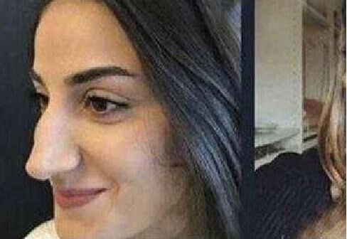 Bütün dünya bu qızın dəyişimindən danışır - FOTO