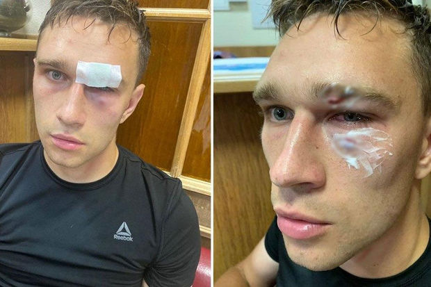 Millinin sabiq futbolçusu baş hakimi xəstəxanalıq etdi - VİDEO