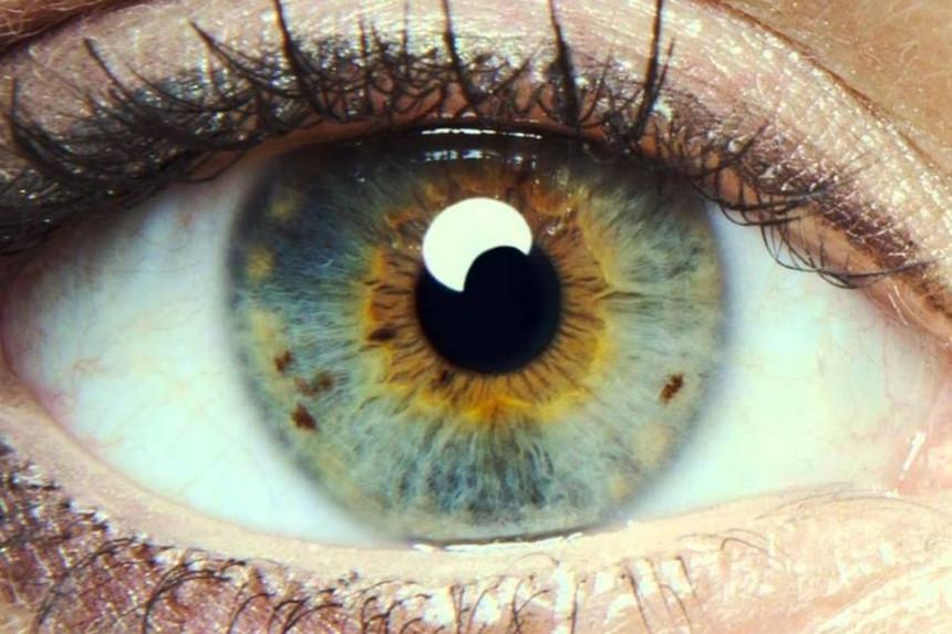 İnsanın öləcəyini gözlərdən bilmək olur