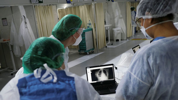 Alimlər koronavirusun radiasiya ilə müalicə üsulunu təklif ediblər