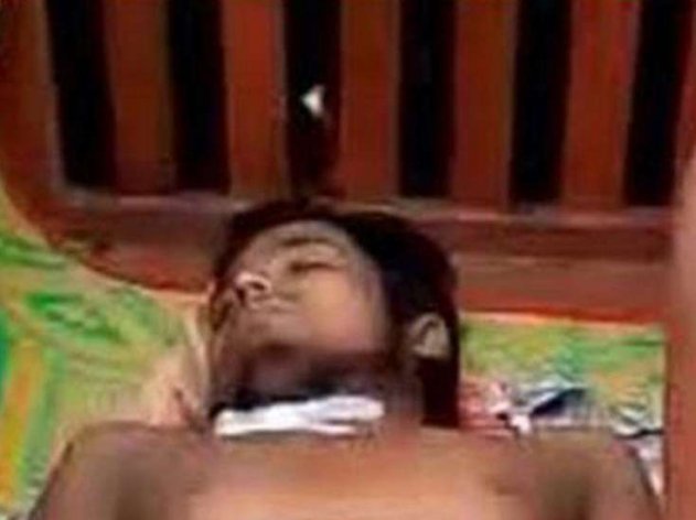 Dəhşət!!Mədəsi ağrıdığına görə xəstəxanaya getdi orqanlarını oğurladılar - FOTO